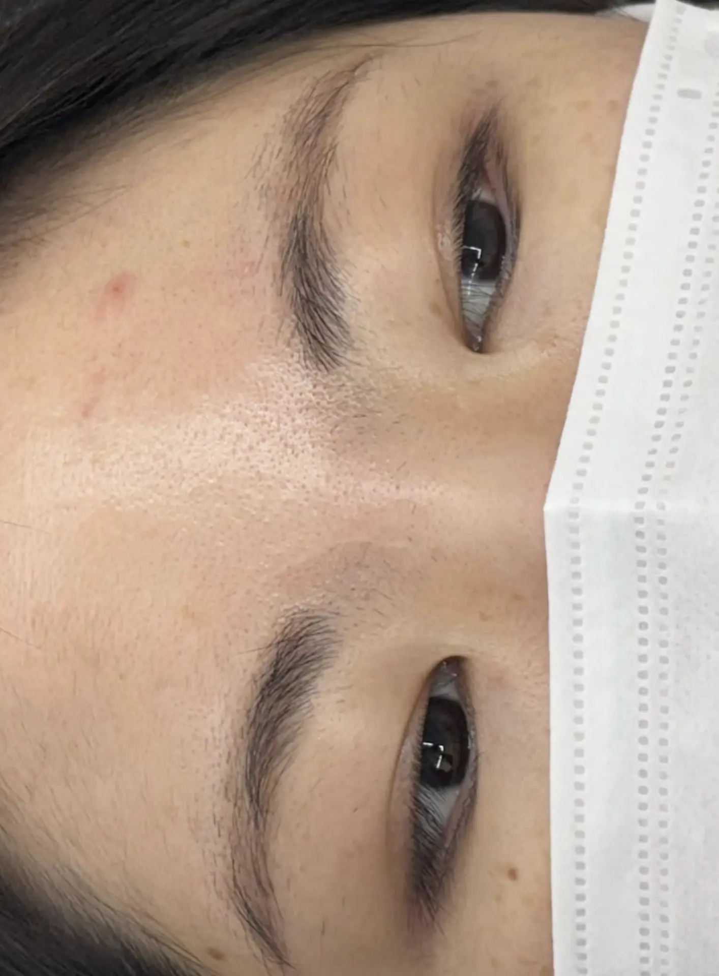 breakouts after eyebrow waxing