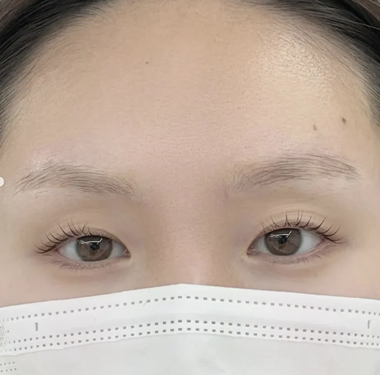 What Is the Ghosting Phase in Microblading?