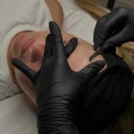 Can Anyone Perform Dermaplaning?