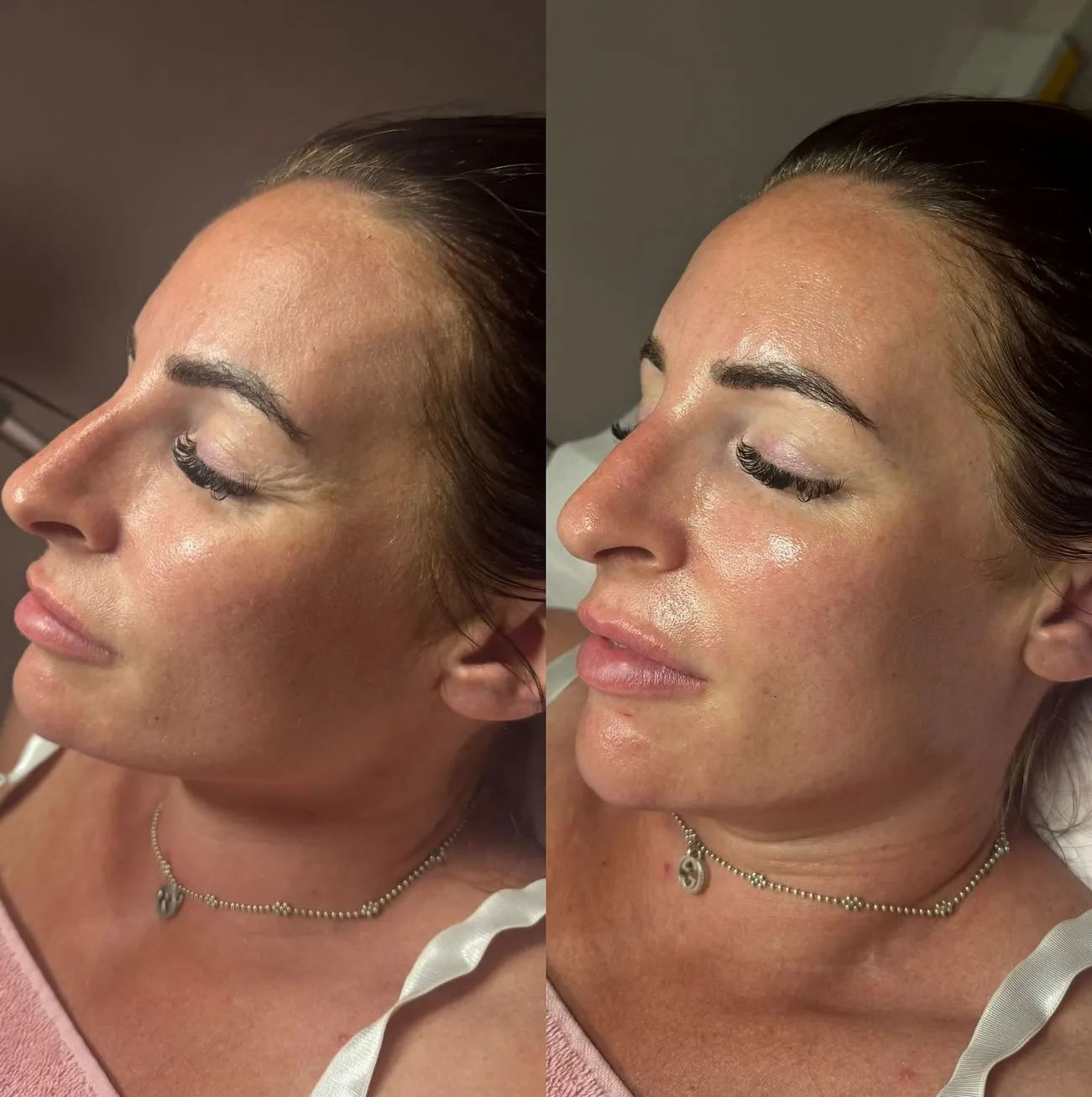 Safe or Skin Disaster