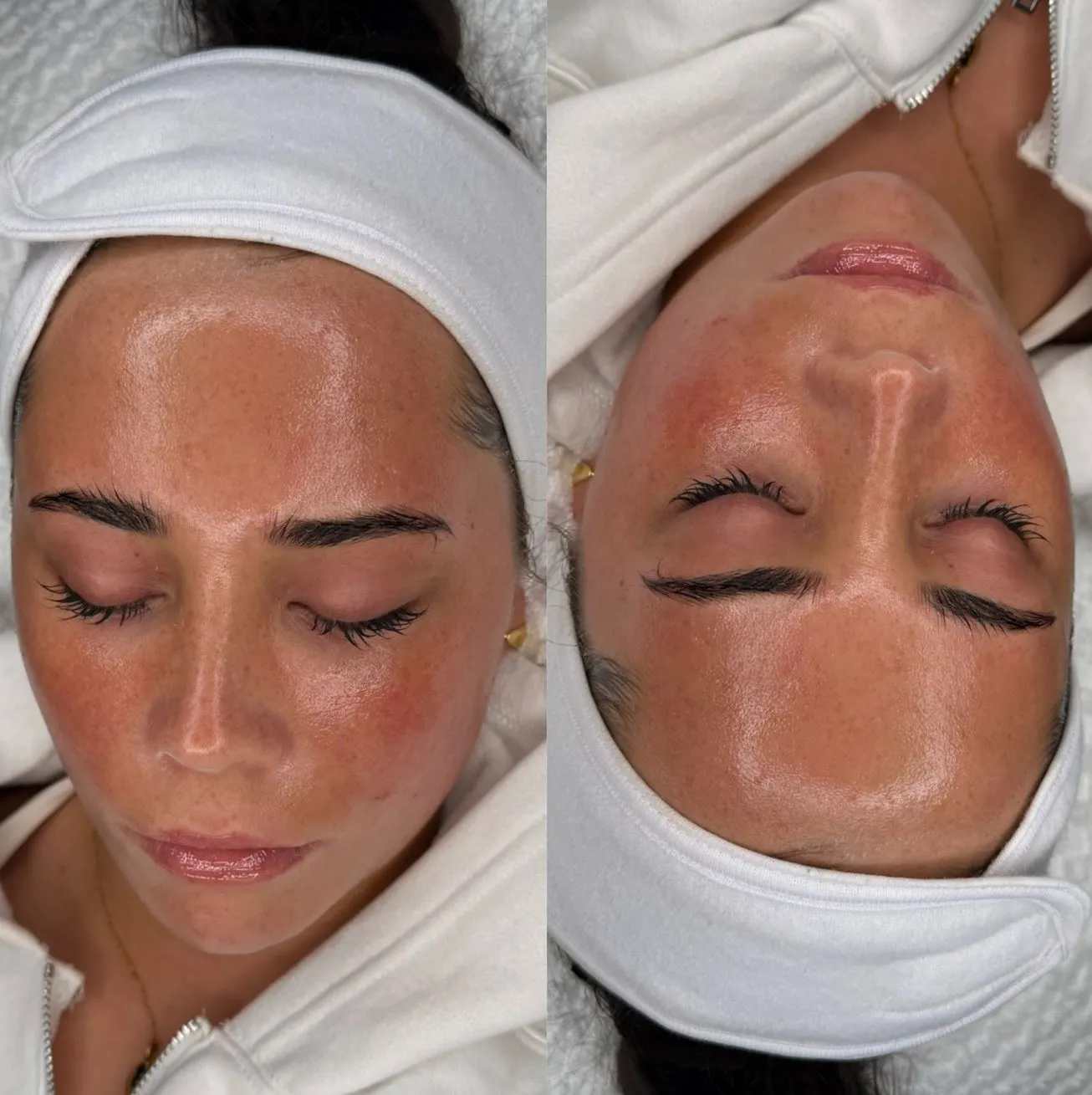 Safe or Skin Disaster