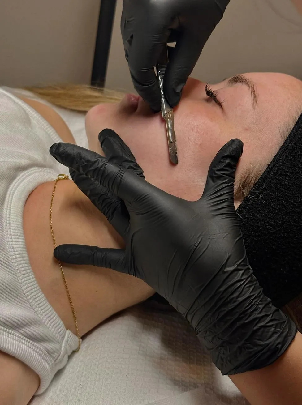dermaplaning course